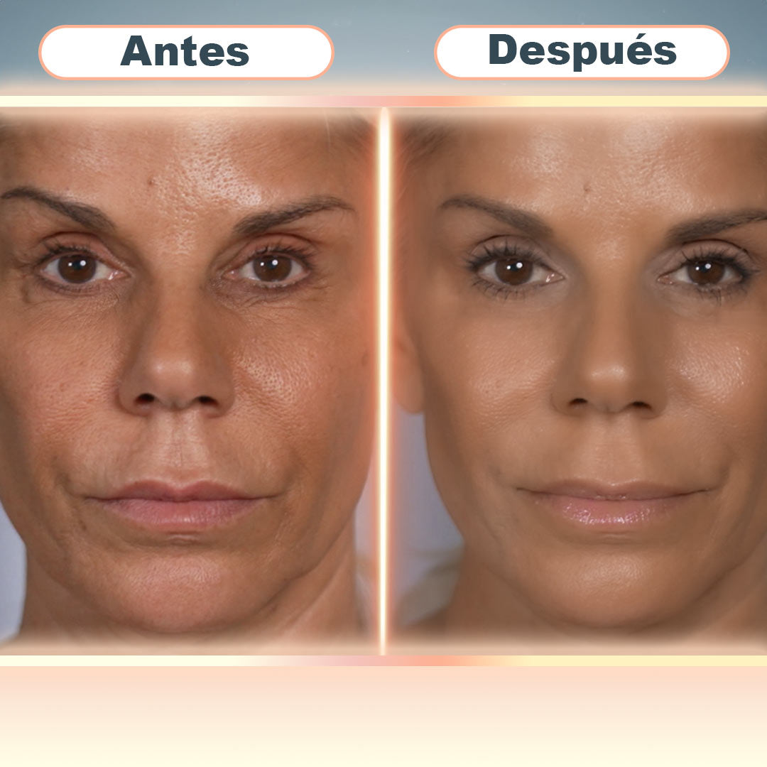 PARCHES VELFOR RENEW