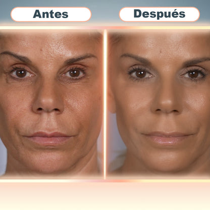 PARCHES VELFOR RENEW