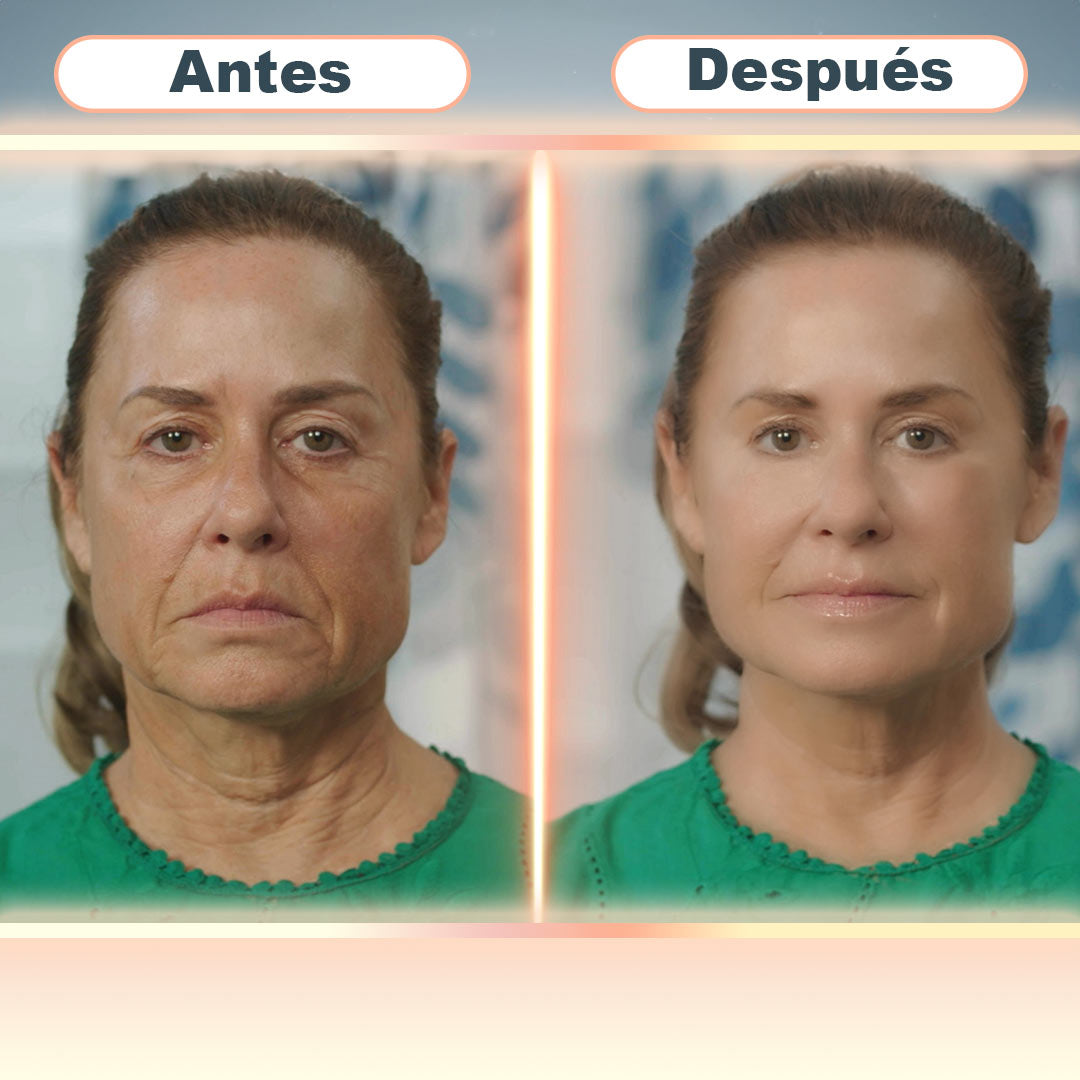 PARCHES VELFOR RENEW